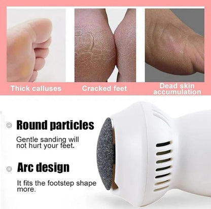 Foot Grinder